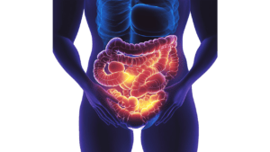 Inflammatory Bowel Disease, and How Does It Impact Gut Immunity
